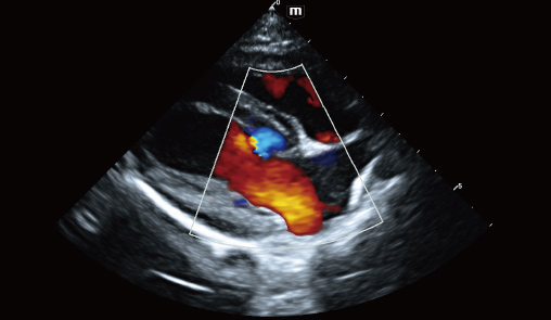 Cardiac blood flow of canine